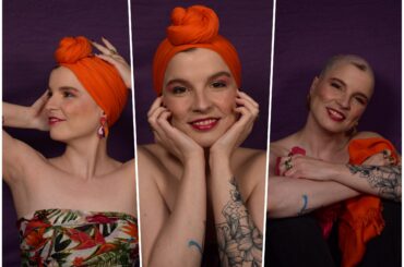 lucija_cec_alopecija