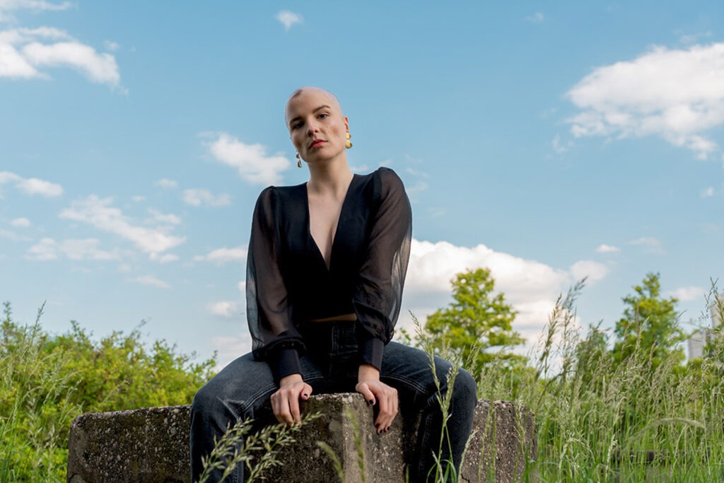 lucija_cec_alopecija_lupus