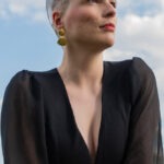 lucija_cec_alopecija