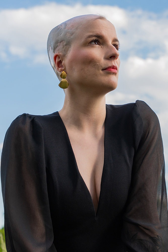 lucija_cec_alopecija