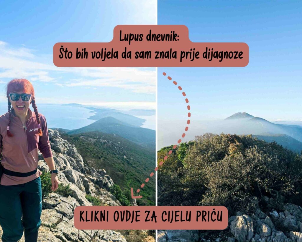 lupus_dnevnik